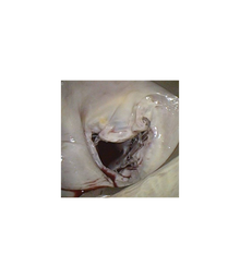 USB Medical HV Heart Retractor