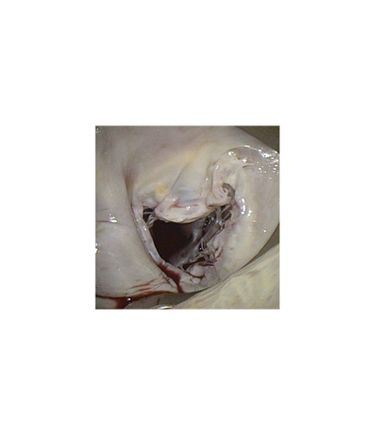 USB Medical HV Heart Retractor